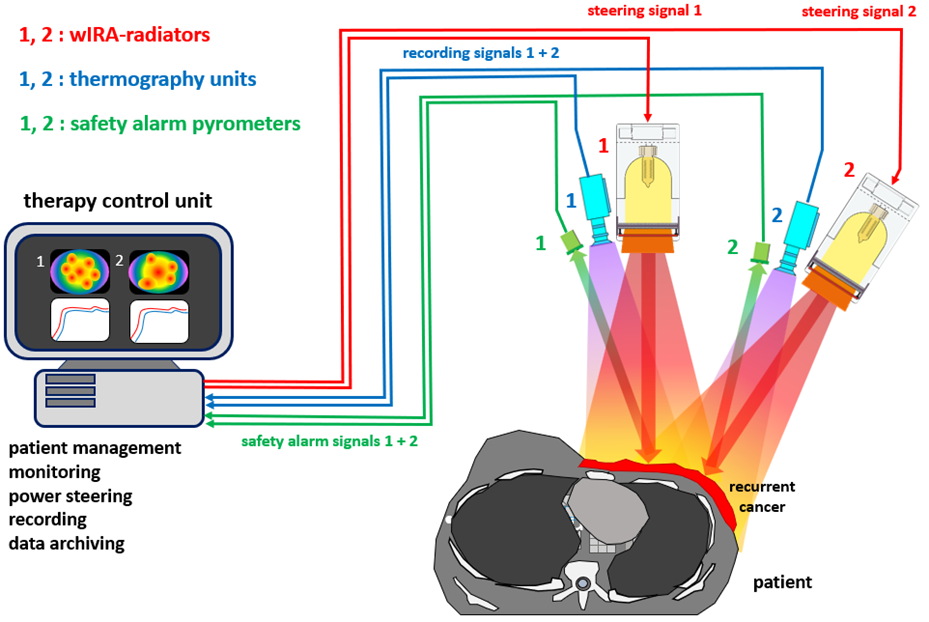 Superficial hyperthermia radiation scheme